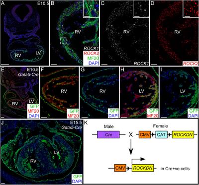 Morphological, electrophysiological, and molecular alterations in foetal noncompacted cardiomyopathy induced by disruption of ROCK signalling